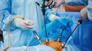 What are Gynaecological Laparoscopic Surgeries?